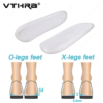 VTHRA 2Pcs Silikoni Insoles Orthotics X/O-lloj Këmbët Corrector Xhel Jastëk Për Takë Ortopedike Shtrojë Këpucëve Jastëk Për Këmbët e Kujdesit të Ngurta